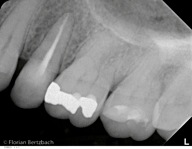 Bertzbach Schwerpunkt Endodontie