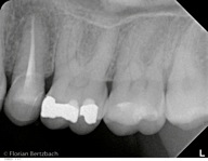 Bertzbach Schwerpunkt Endodontie