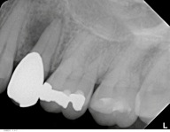 Bertzbach Schwerpunkt Endodontie