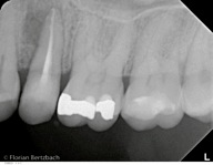 Bertzbach Schwerpunkt Endodontie