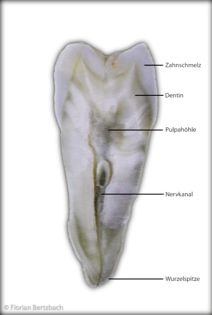 Bertzbach Schwerpunkt Endodontie